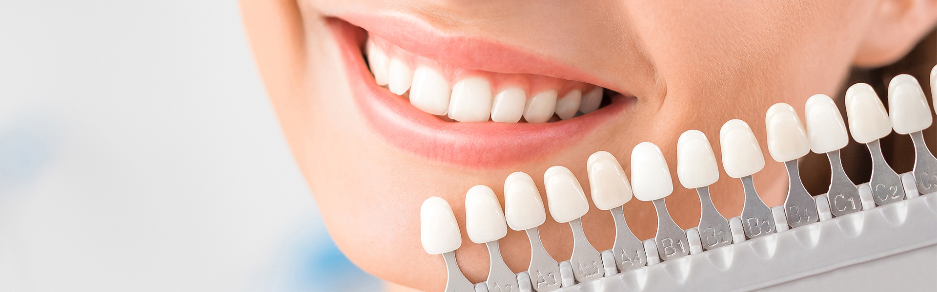 Dental Veneers: A Quick Fix for Chipped, Gapped, and Stained Teeth