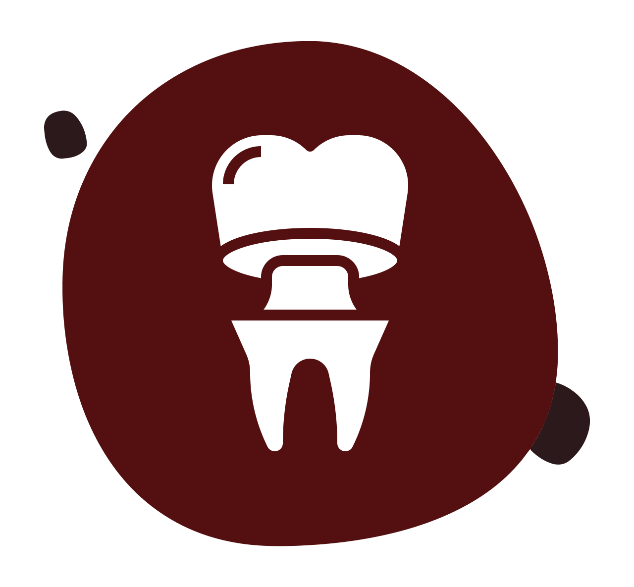 Same-Day Crowns
